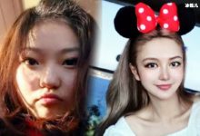 网上网友整容大有人在，还我帅气的“小猎豹”是什么梗？-捕鱼中文站