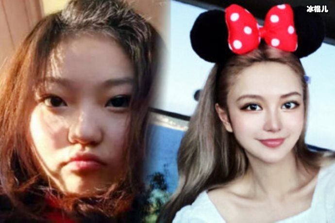 网上网友整容大有人在,还我帅气的“小猎豹”是什么梗?