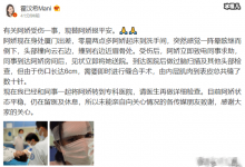 敬业!阿娇眉骨受伤坚持复工拍戏,杀青照用手遮掩伤疤-捕鱼中文站