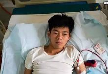 9年前卖肾买手机的小伙子怎么样了? 起底其现状惨不忍睹！-捕鱼中文站