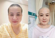 岳云鹏老婆回应生病剃光头! 她得了什么病身体现状如何-捕鱼中文站