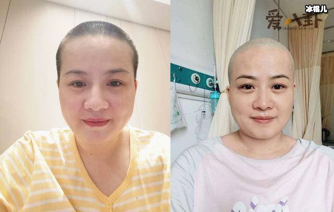 岳云鹏老婆回应生病剃光头! 她得了什么病身体现状如何