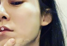 范玮琪发生了什么下巴缝15针?为何其那么遭网友嫌弃?-捕鱼中文站