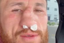 梅拉布·德瓦利什维利鼻骨两处骨折仍要打！放话硬刚亨利·塞胡多，大发体育助力你的致富之路！-捕鱼中文站