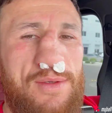 梅拉布·德瓦利什维利鼻骨两处骨折仍要打！放话硬刚亨利·塞胡多，大发体育助力你的致富之路！